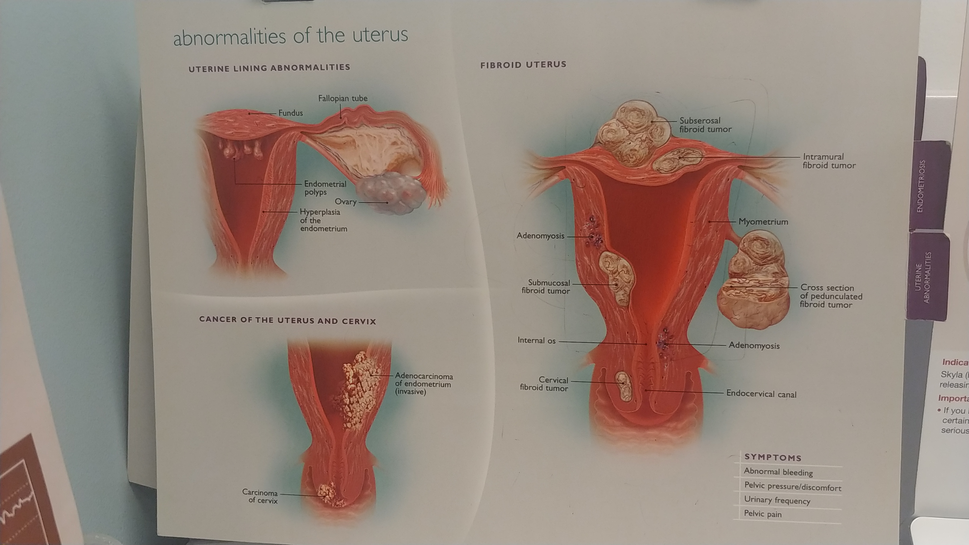 spiritual-root-of-uterine-fibroids